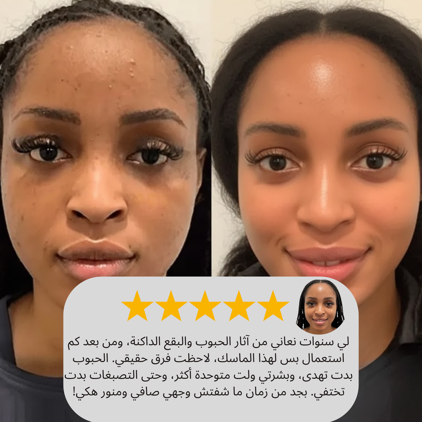 ماسك يوري الكوري بالكولاجين – لبشرة مشدودة، ناعمة وزجاجية من أول استعمال